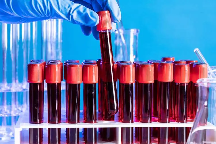 研究发现血型与疾病的发生有相关性