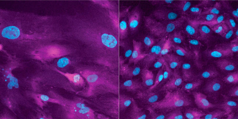 研究人员发现癌症的致命弱点