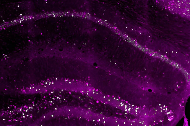 研究发现大脑可存储三份记忆副本